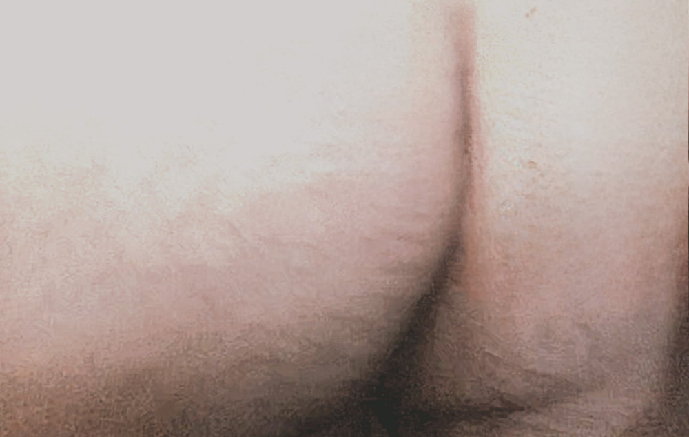 Hairy Chest, Shaved Balls, Tied Ass #25