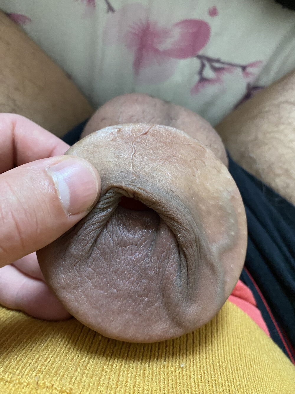 Foreskin extreme torture porn