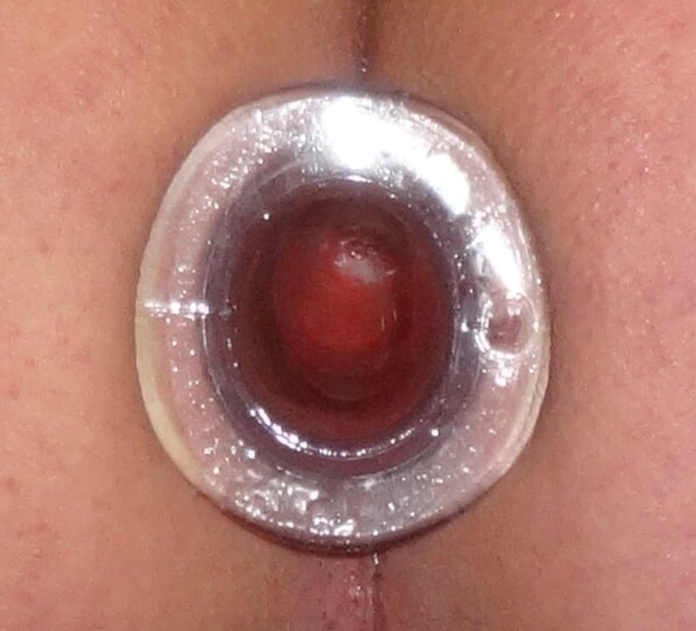 My butt hole #14