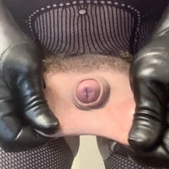 Micropenis