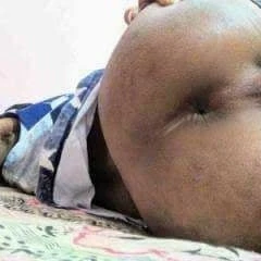 Ass hole 