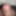 My Penis head