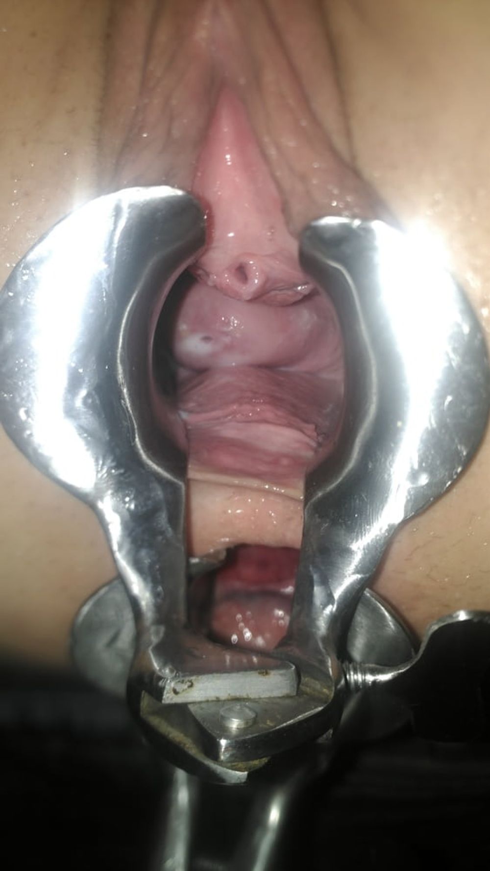 Double speculum  #4