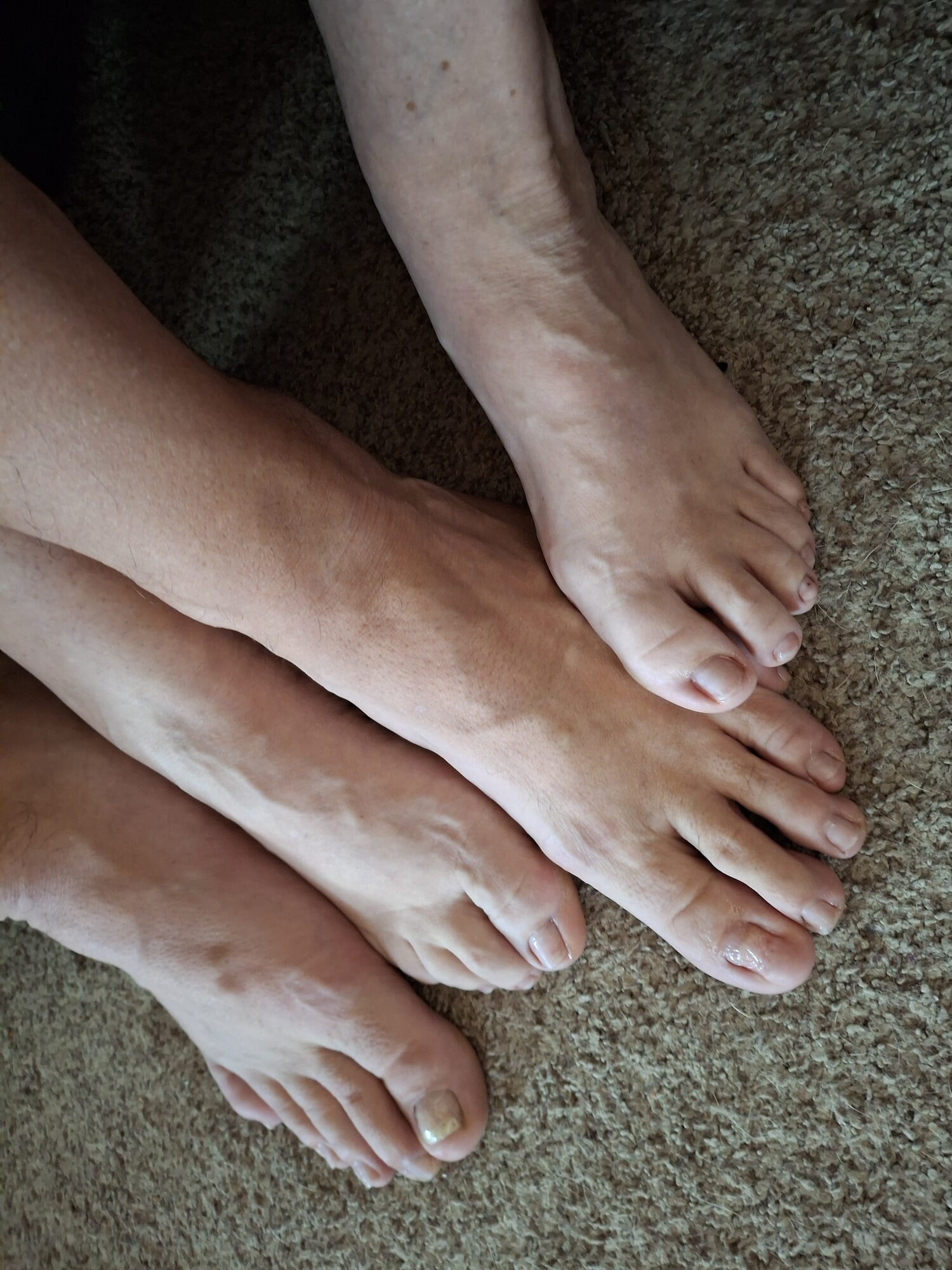 Showing off our un polished toes #7