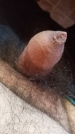 أنا بريزينوتو