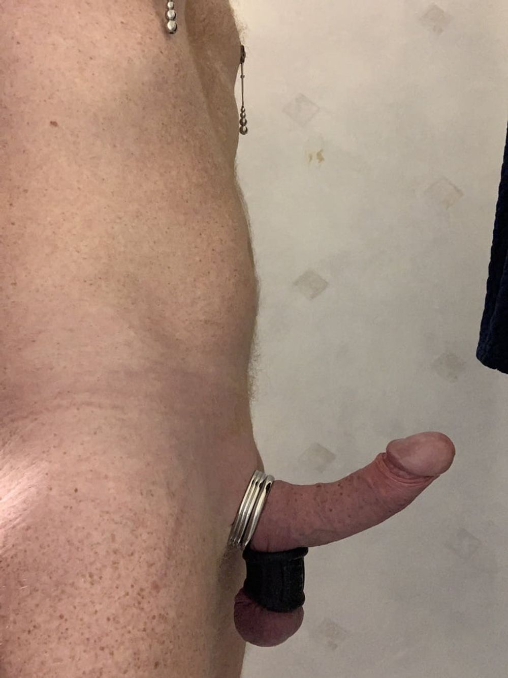 Prostate fun #3