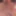 Facial