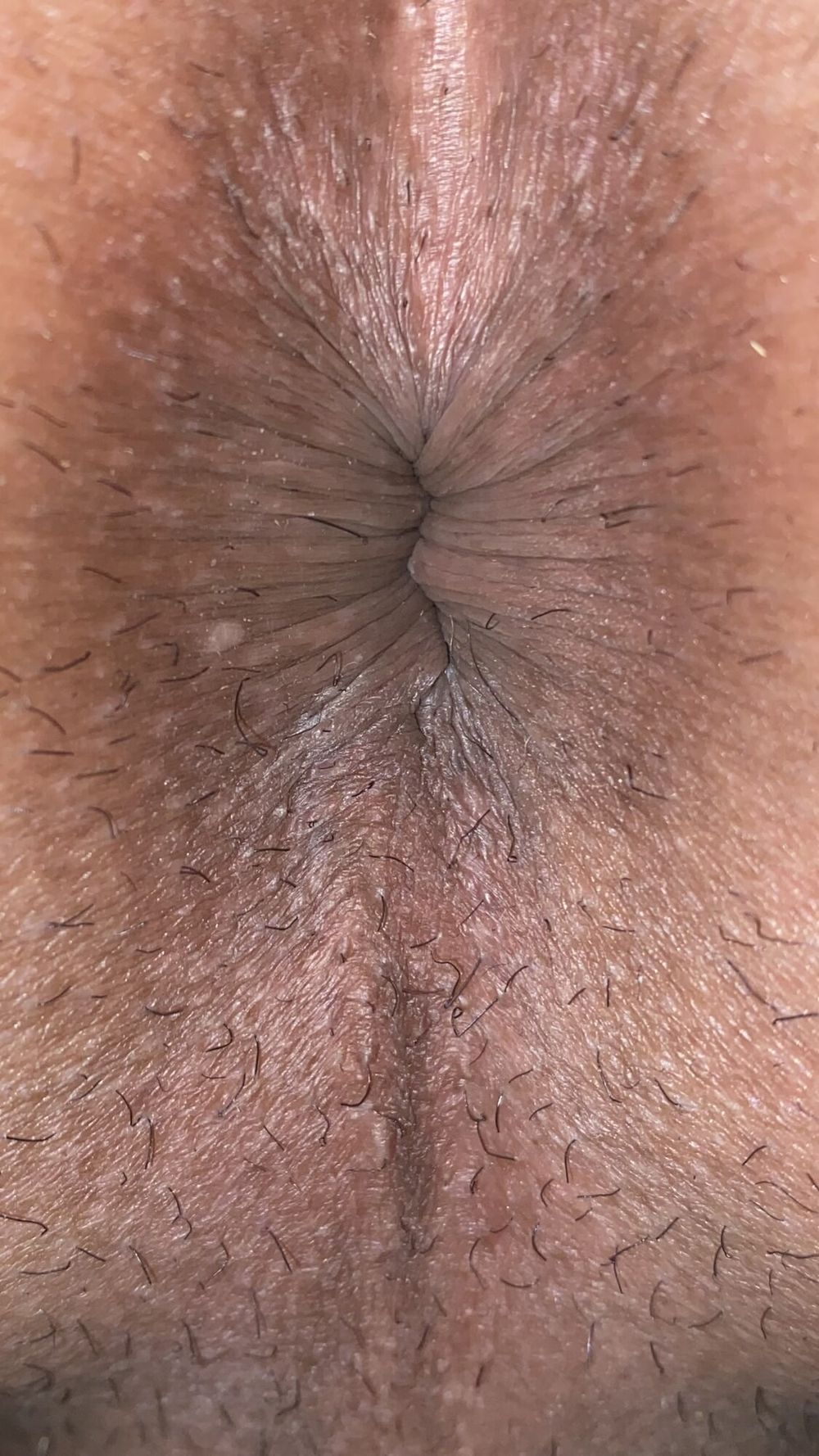 Close-up of a man&#039;s anus #25