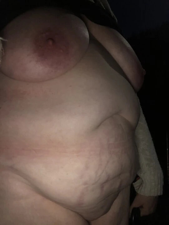 Stomach