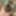 extended foreskin #2