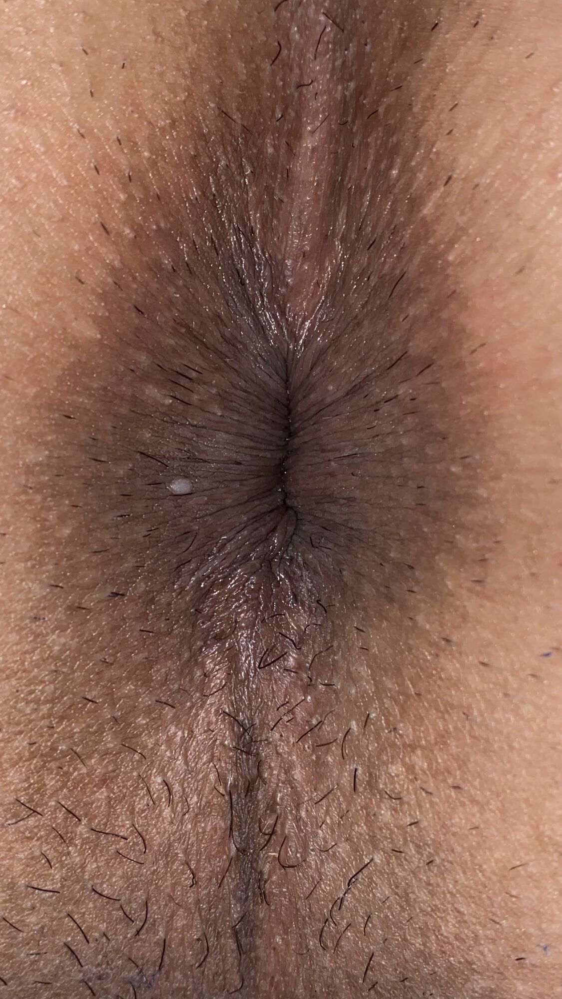 An image of my anus that is clear to every single wrinkle #15