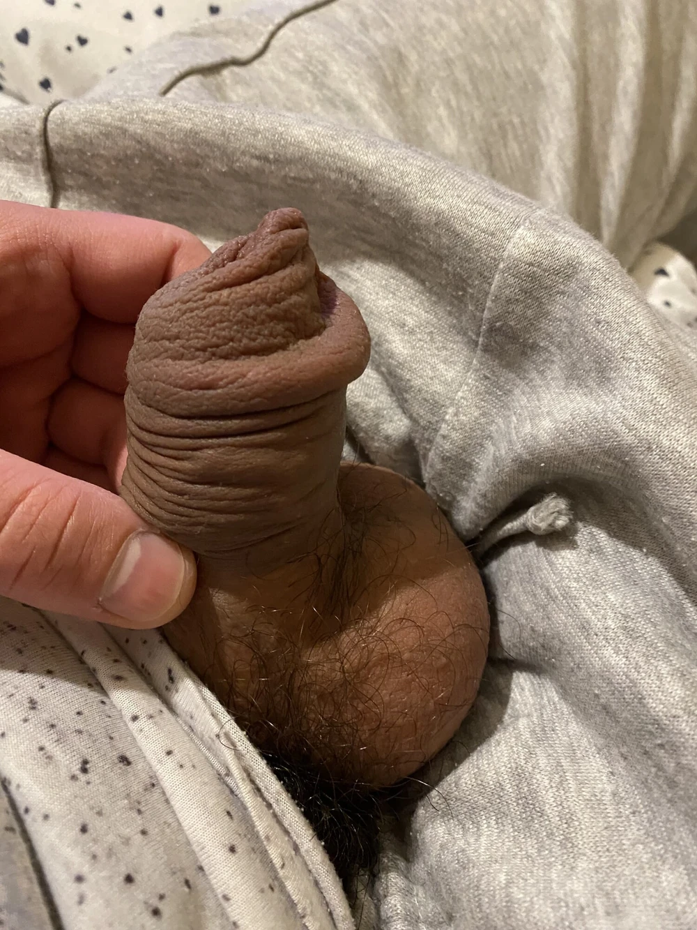 extended foreskin
