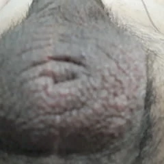 Hairy Balls