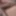 Dick