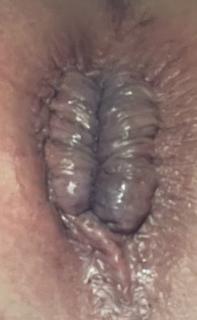 Gaping hole