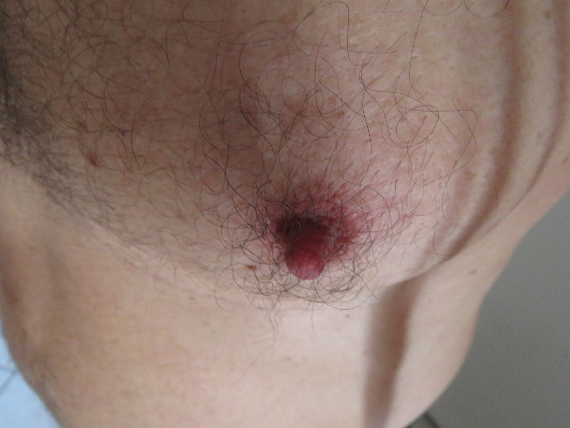 nipple torture #14