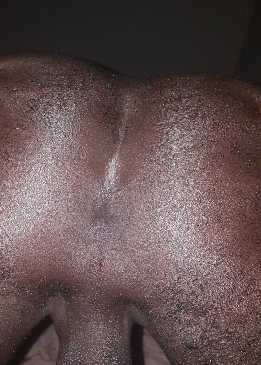 Black butt 