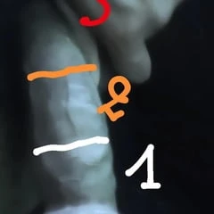 My penis size 