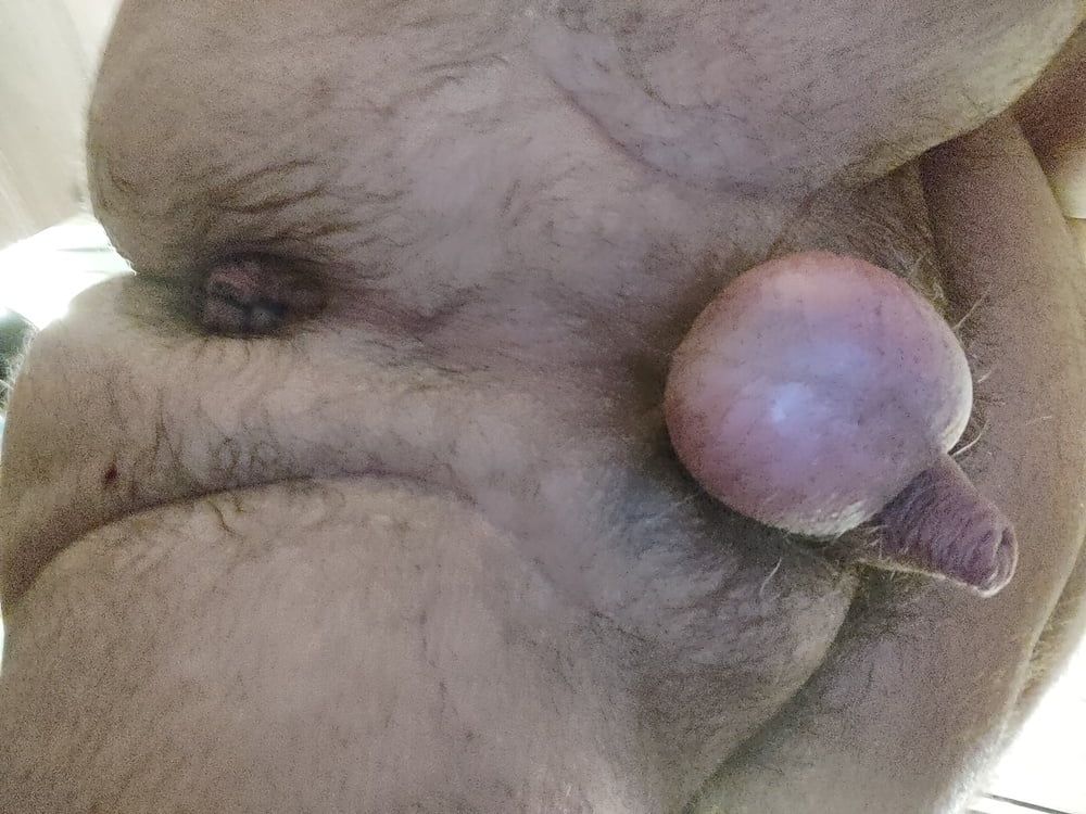 Some pics of my strnage dick #3