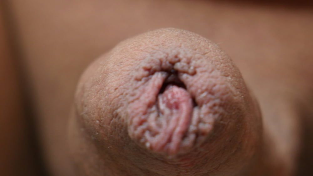 Foreskin 