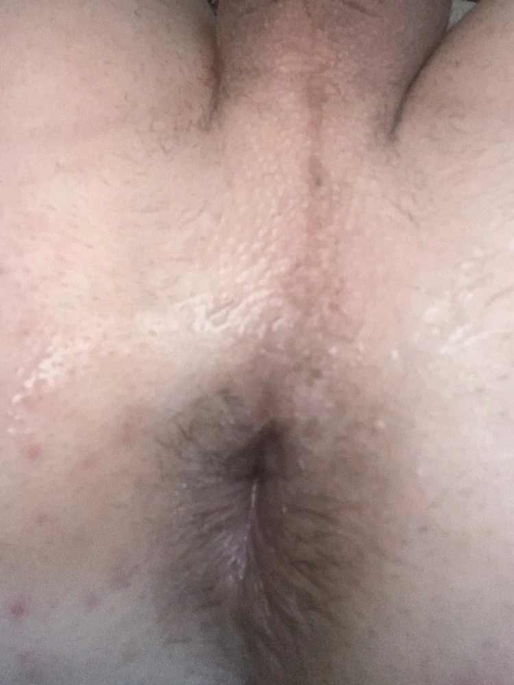 My gaped hole #4