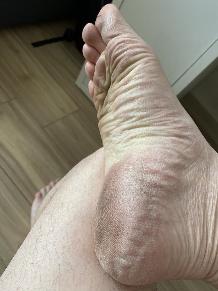 My close-up feet and soles #9