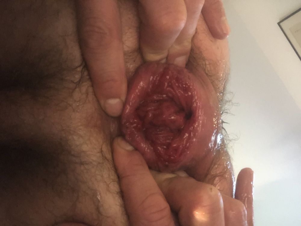 My open cunt #4