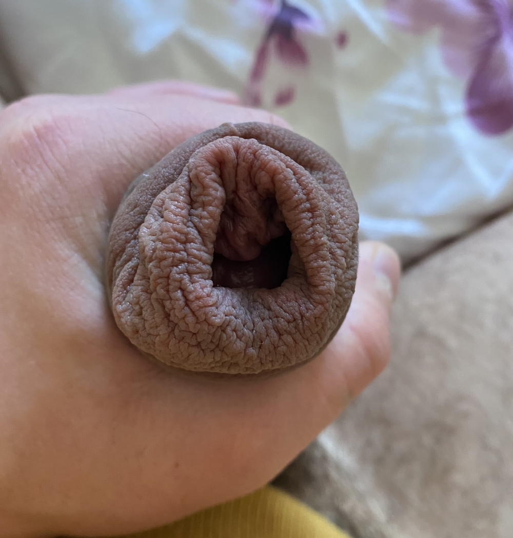 Extreme stretching foreskin #7