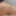 Teaser 