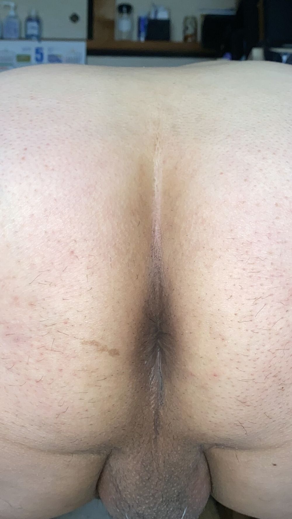 An image of my anus that is clear to every single wrinkle #35