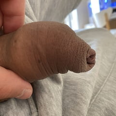 非常宽松的包皮