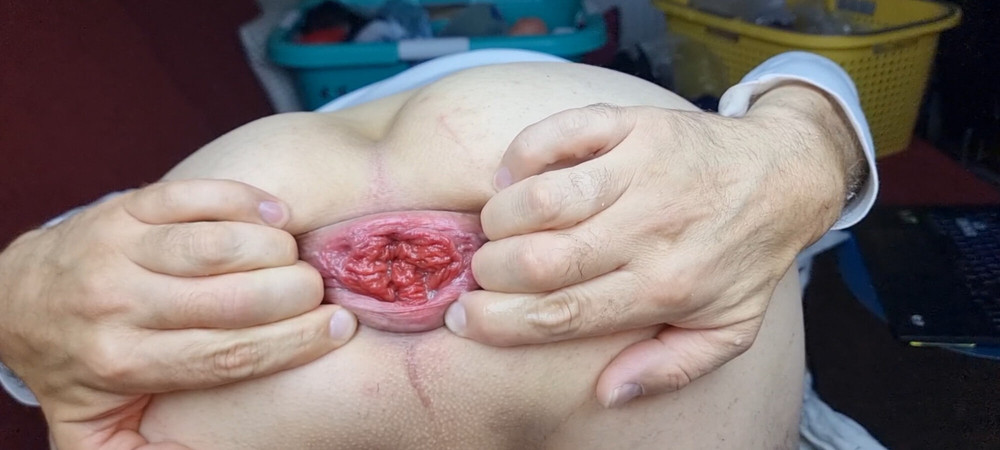 My sweet asshole spread and prolapse! #12