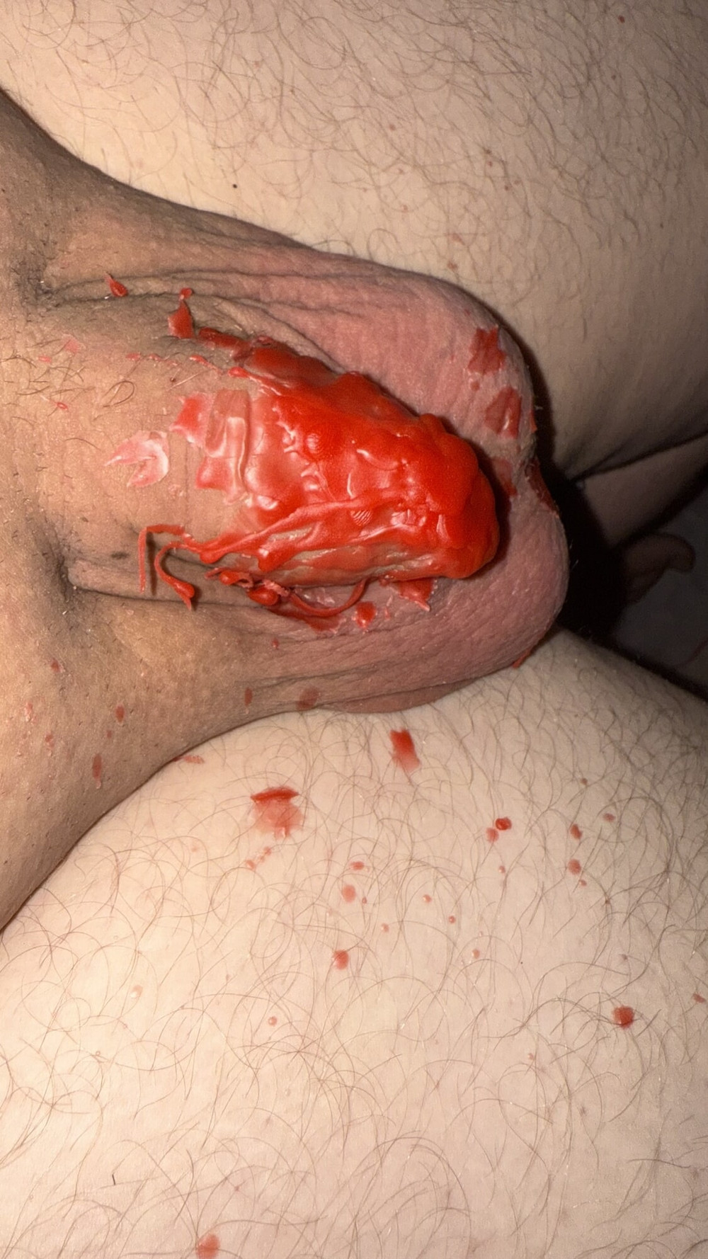foreskin closed with candle wax #7
