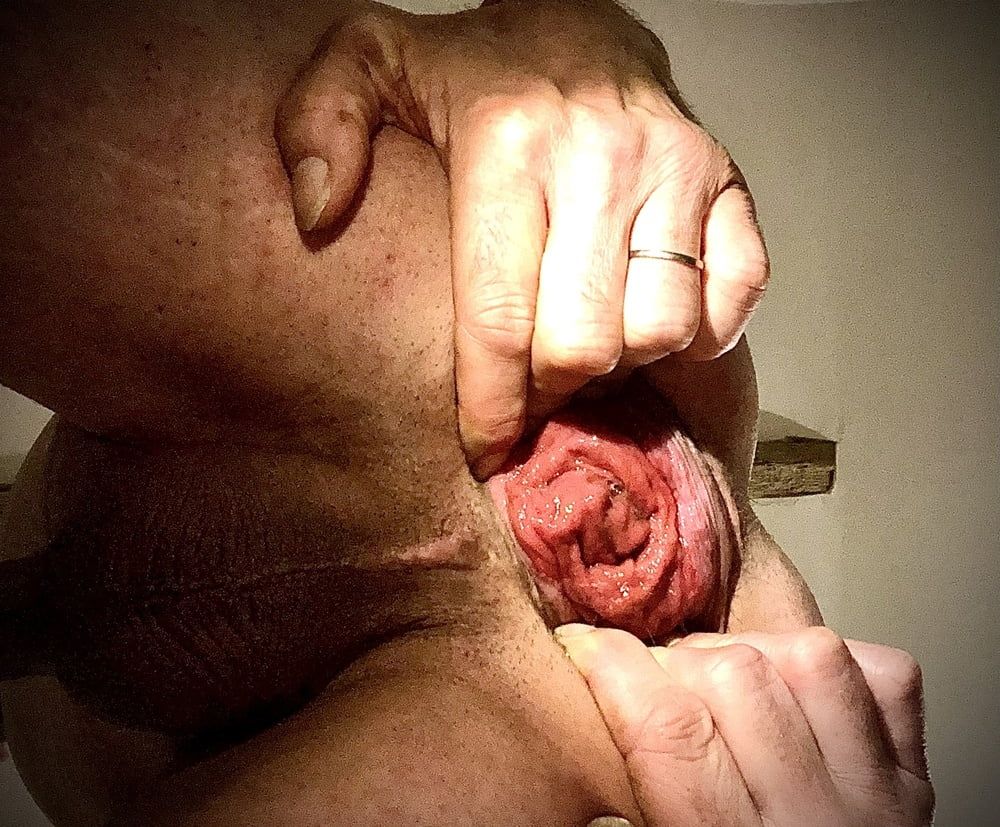 anal dilation after big insertion #20