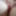 My labia