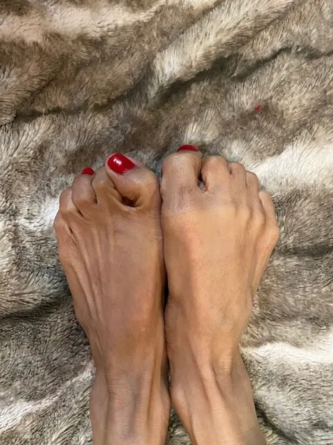 Red Toe Nails #2