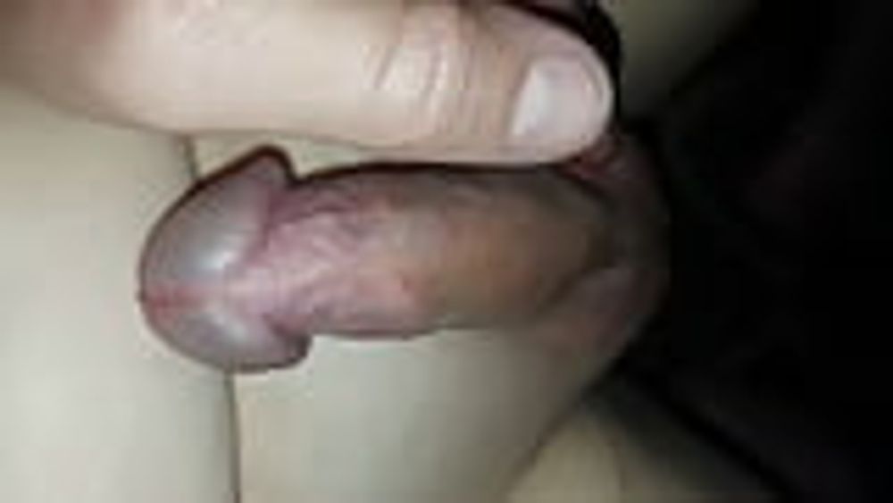 Tiny Cock Micropenis Small Dick #27