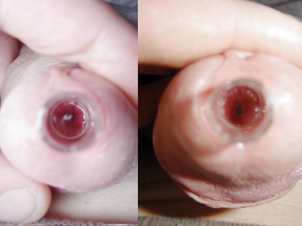 bdsm extreme insertions urethral anal femdom #52