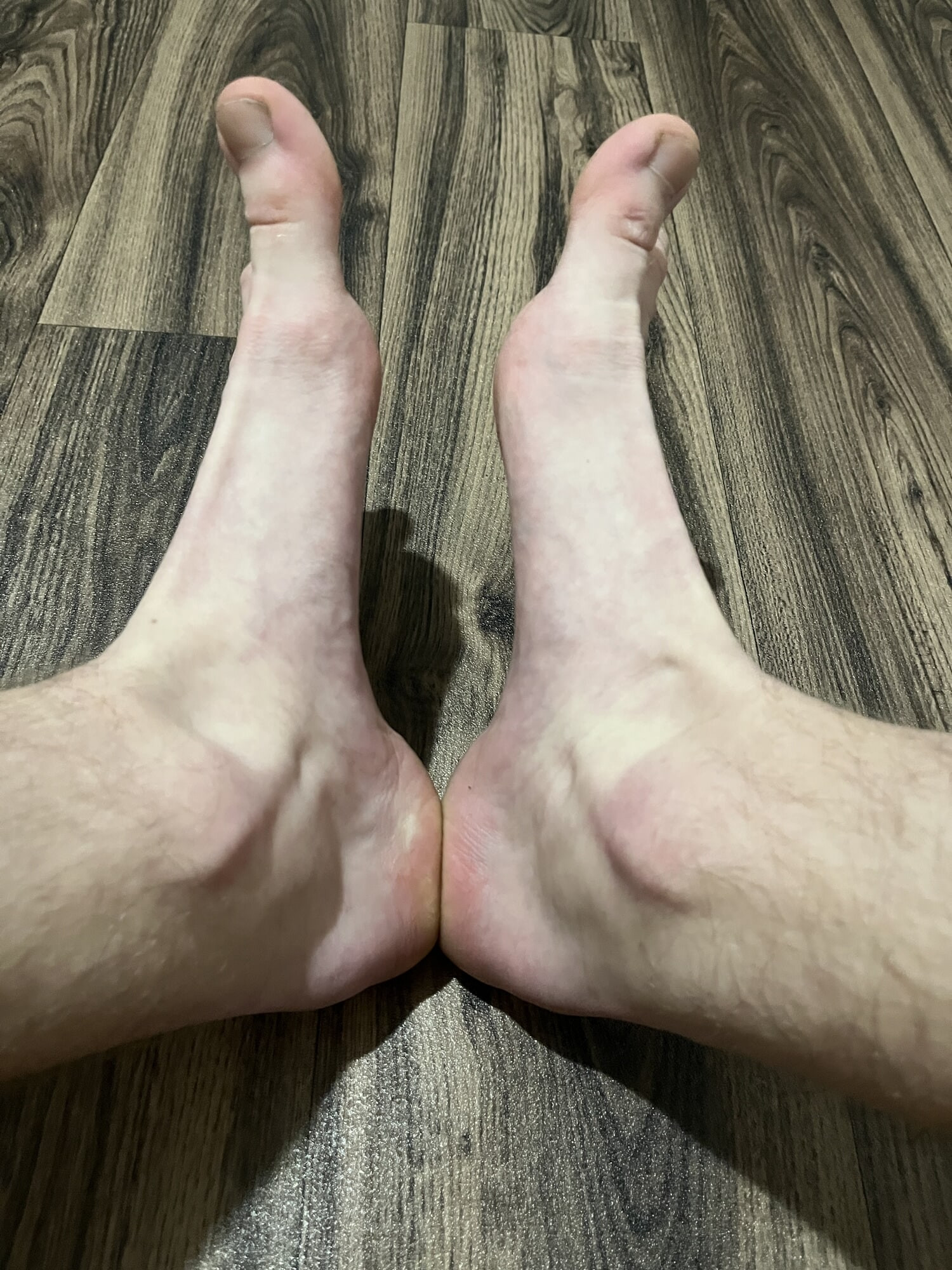 My feet #37