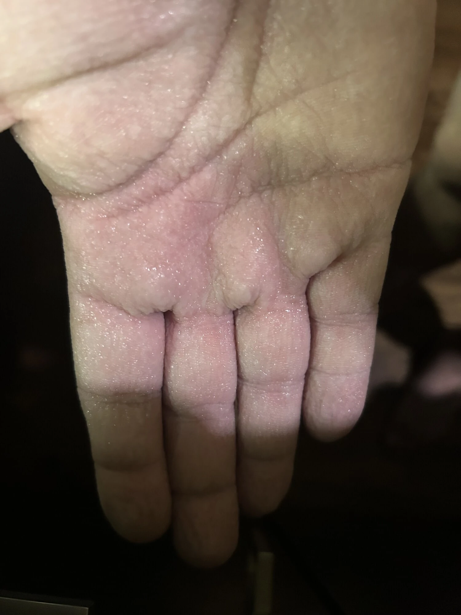 pruny
