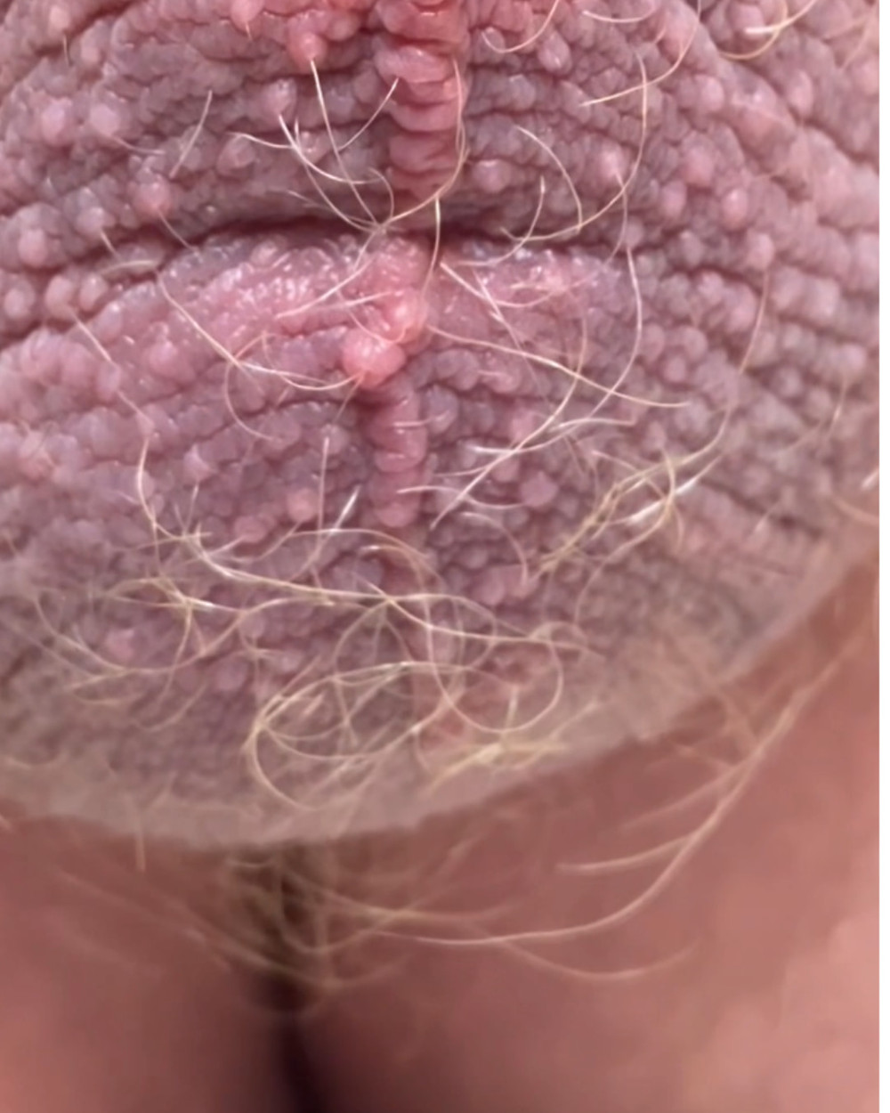 Compilation of uncut cock pics #37