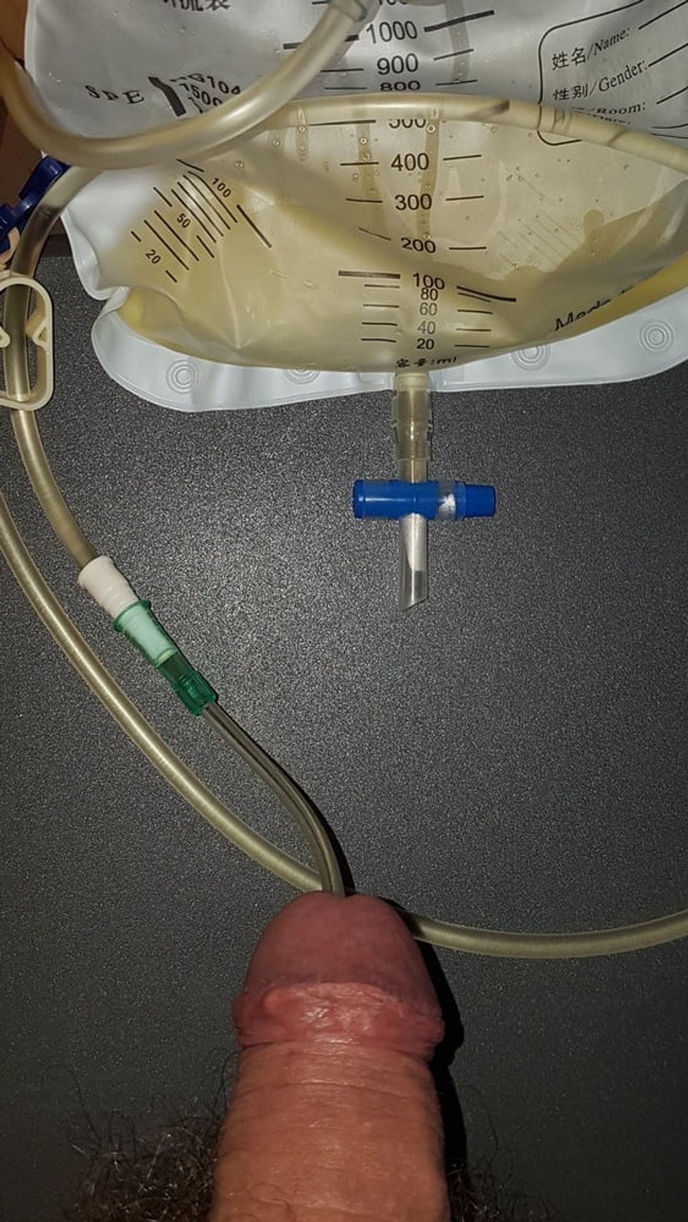 Catheter sounding with my urine 2 #35