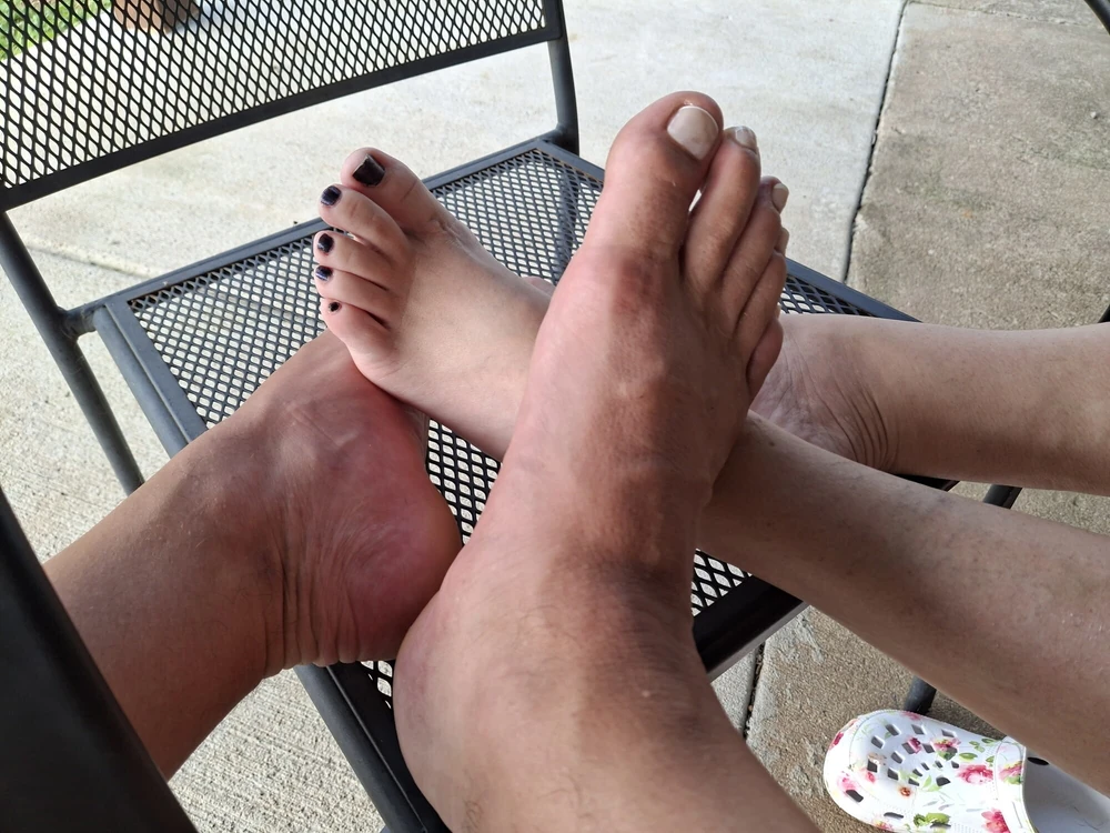 Foot comparison #43