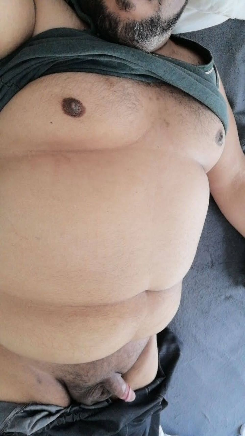 My fat body #3