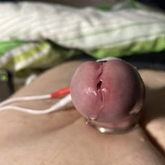 E-stim