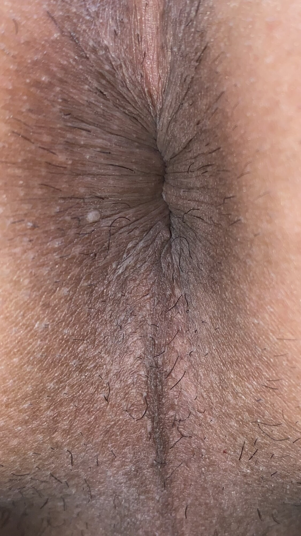 Close-up of a man&#039;s anus #11