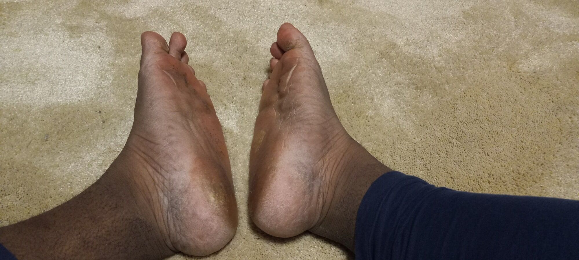 Pics of my Feet #22