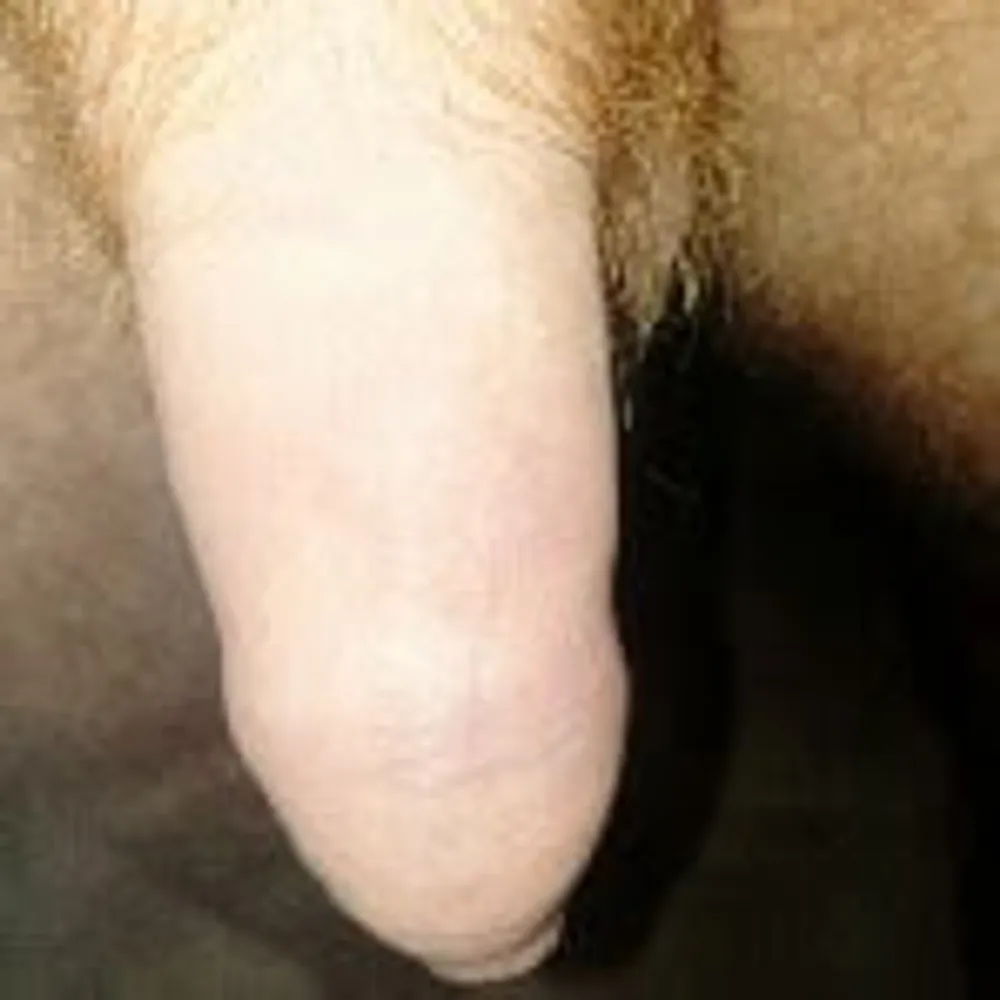 few pics of my uncut cock #5