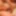 Doctor examines teen with a tight foreskin