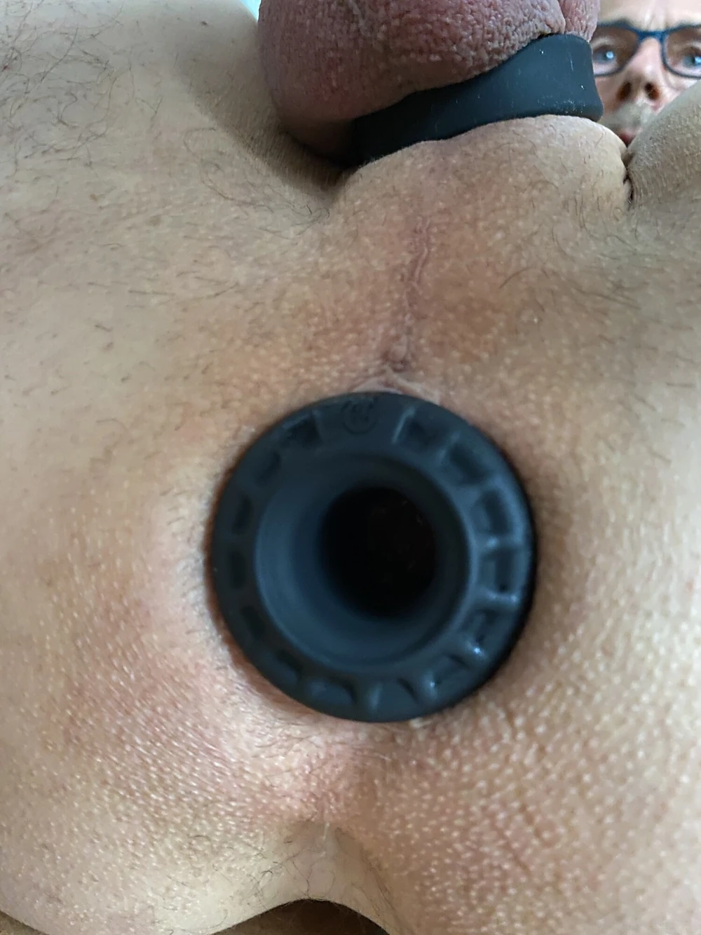 tunnel plug